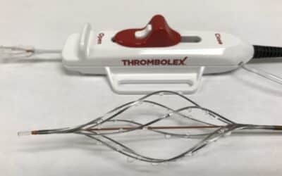First patient enrolled in RESCUE trial of Thrombolex’s Bashir catheter