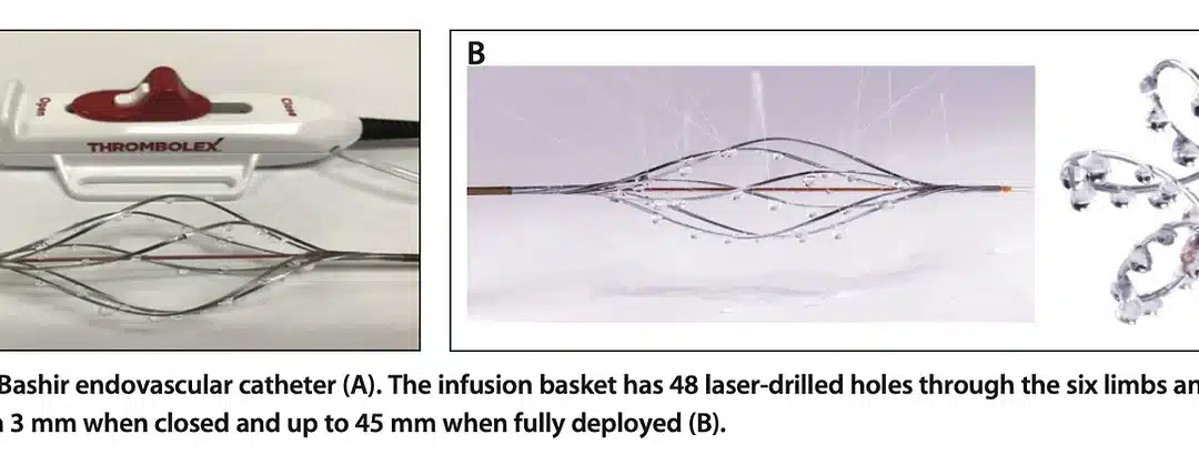 The Search for the Holy Grail of New PE Devices