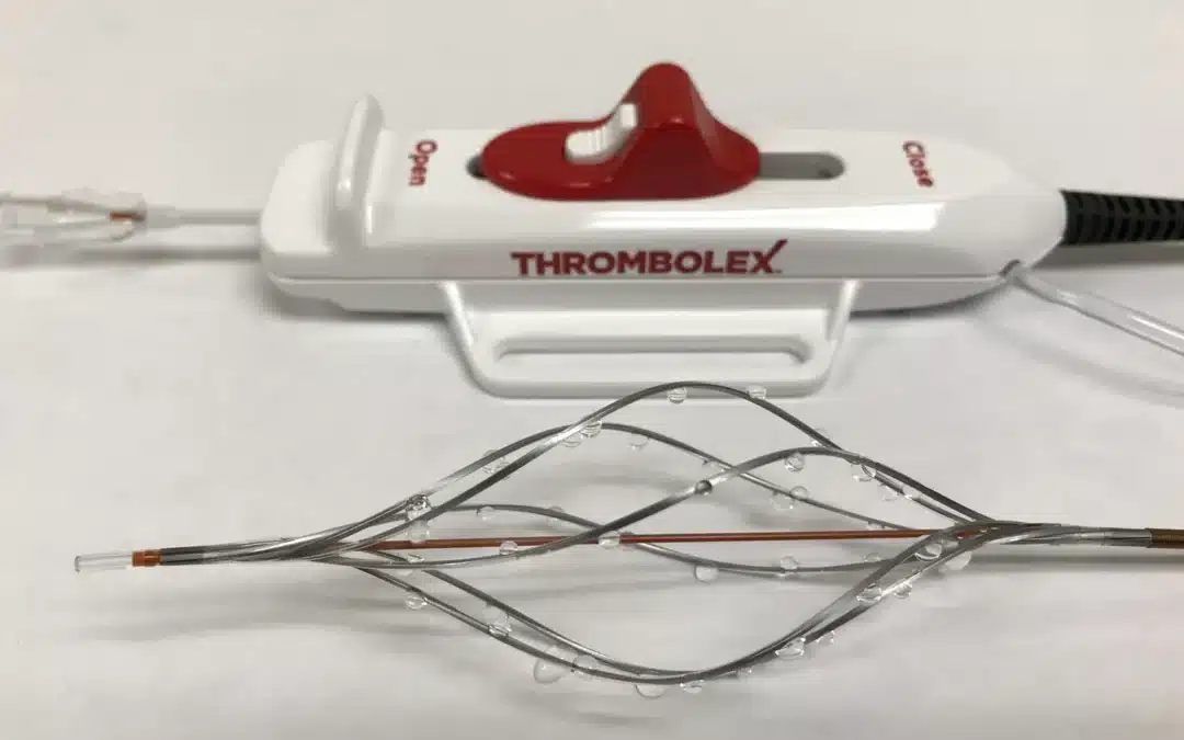 Thrombolex announces 510(k) clearance of Bashir catheter systems for thromboembolic disorders