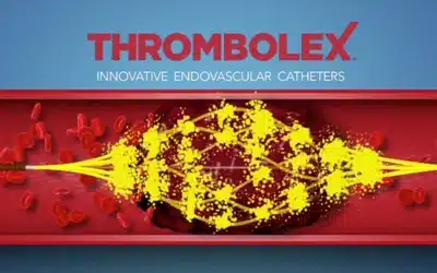 Benefits of Achieving Robust Clot Resolution in VTE Patients…