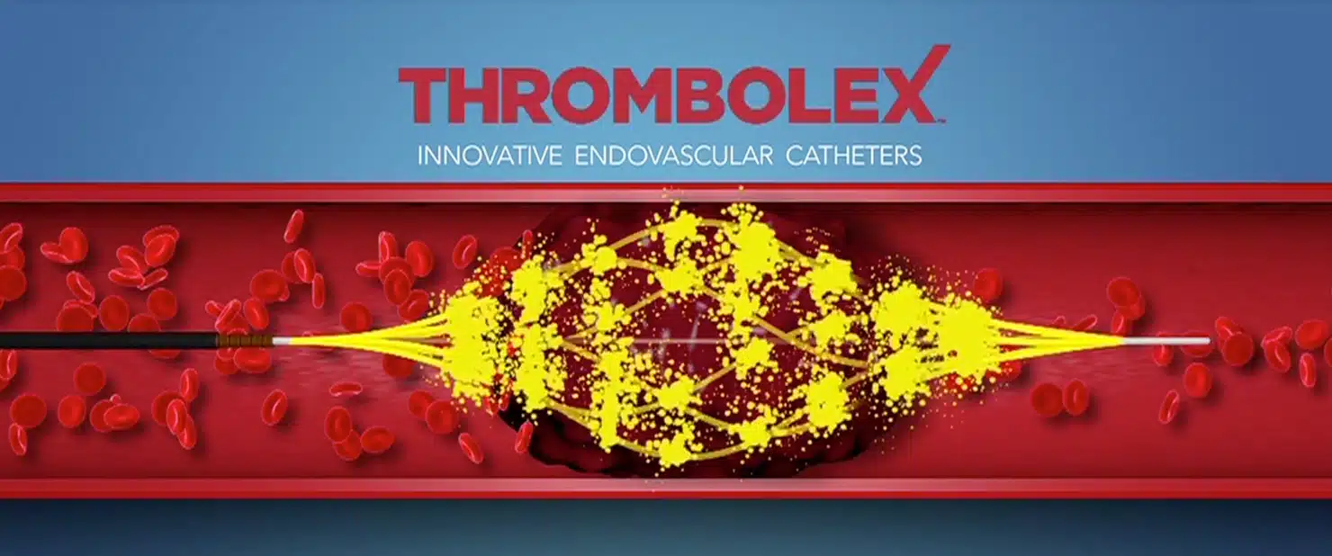 Bashir catheter systems for thromboembolic disorders