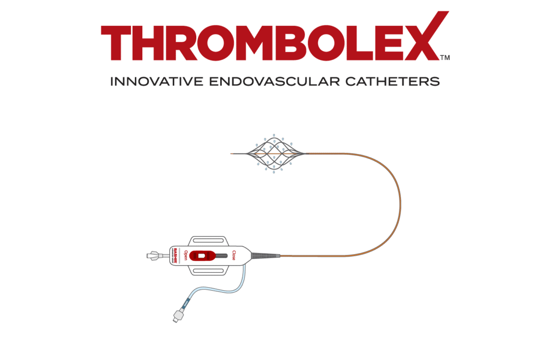 Thrombolex Receives 510(k) Clearance for Treatment of Acute Pulmonary Embolism