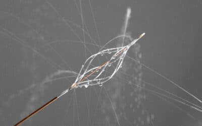 First Patient Enrolled In Thrombolex’s RESCUE II Study — On-Table Pharmacomechanical Lysis Without Post-Procedural Infusion 